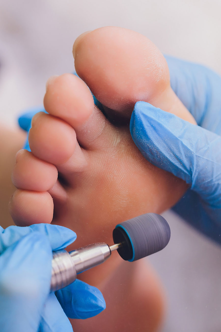 Kapturki do pedicure